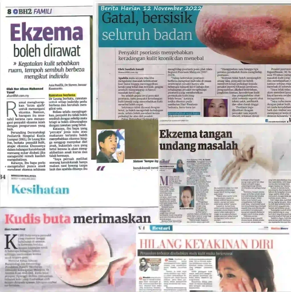 Keratan Akhbar OzPure - FORU | Malaysia Eczema Skincare and Sensitive Skin Solutions