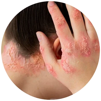 Layer 1 copy 2 1 - FORU | Malaysia Eczema Skincare and Sensitive Skin Solutions