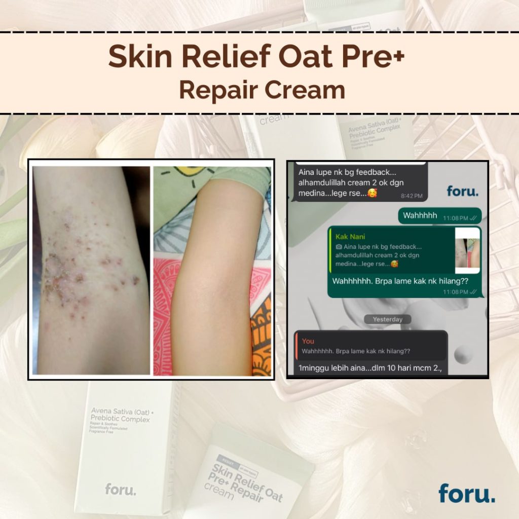 review kak nani - FORU | Malaysia Eczema Skincare and Sensitive Skin Solutions