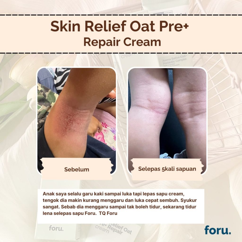 review owner - FORU | Malaysia Eczema Skincare and Sensitive Skin Solutions