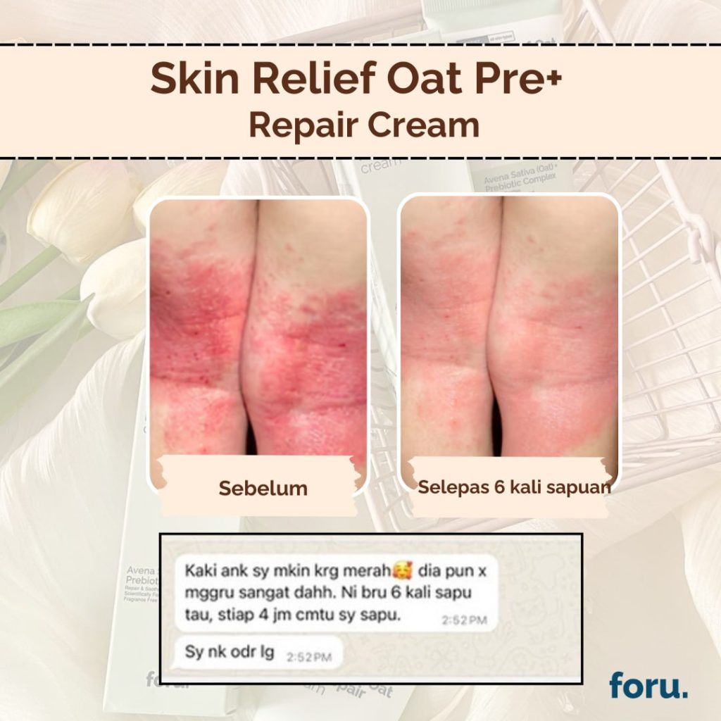 review puan airin - FORU | Malaysia Eczema Skincare and Sensitive Skin Solutions